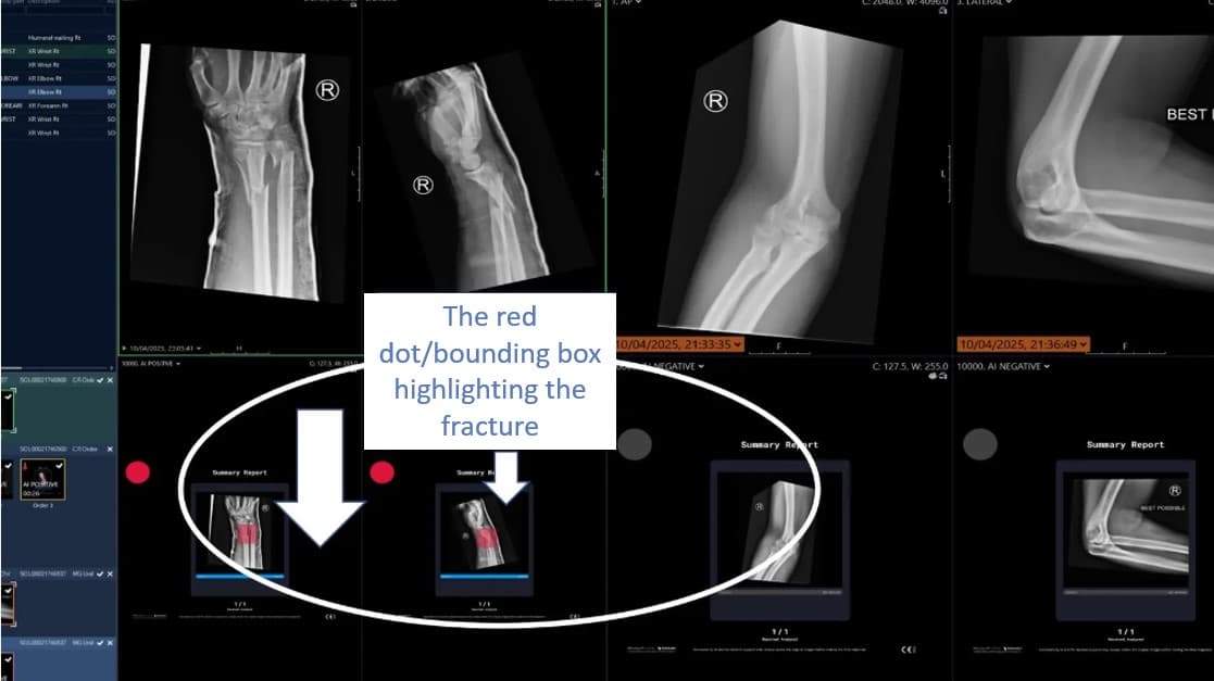 AI-Powered Radiology Reporting Delivers Results for Patients and Staff at Lewisham and Greenwich NHS Trust  