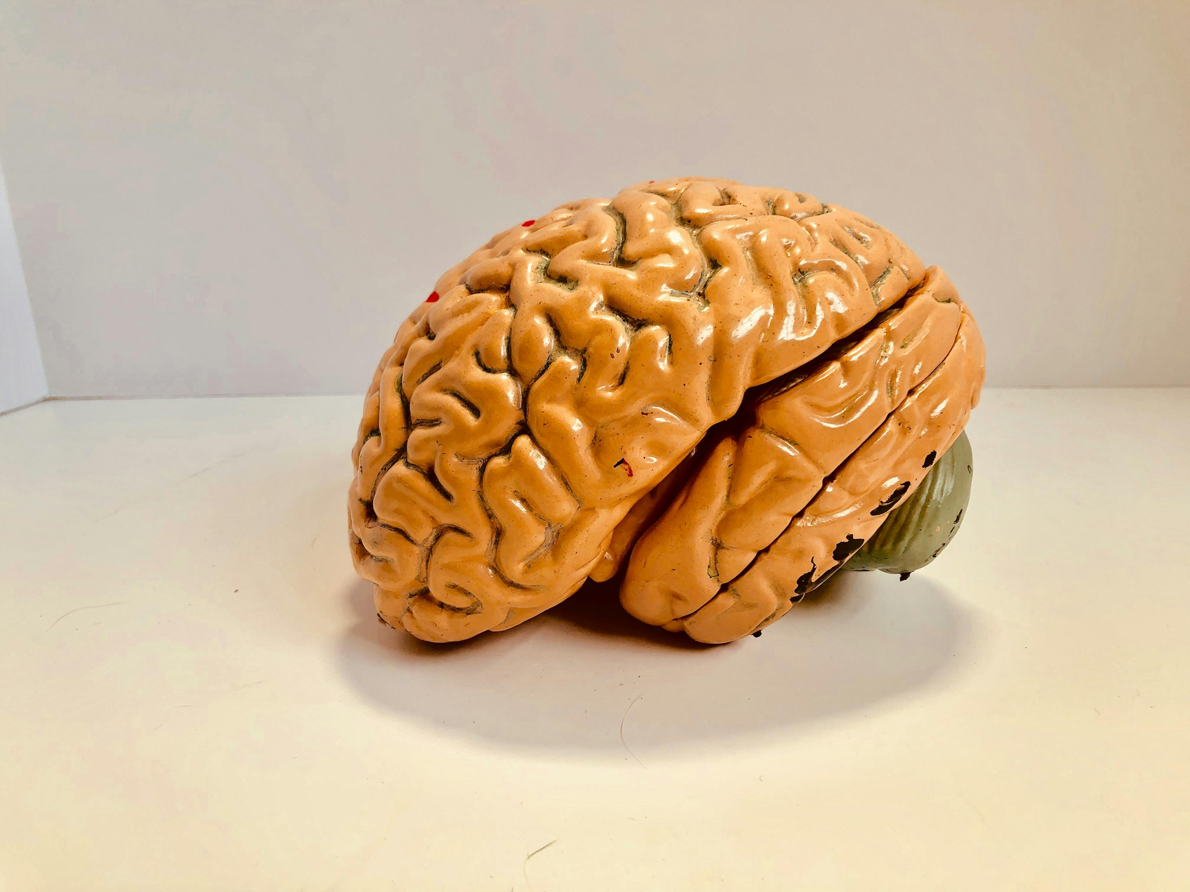 Anatomical model of a brain