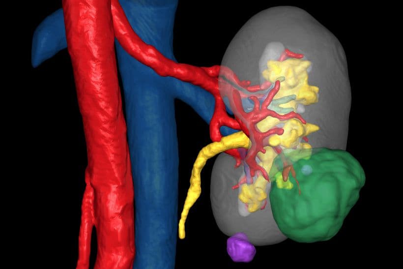 Preoperative Planning